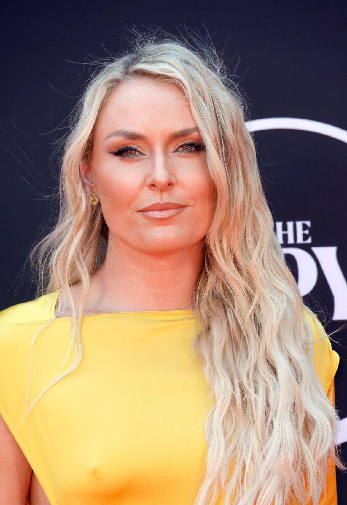 Lindsey Vonn: From Skiing Champion to Inspirational Advocate