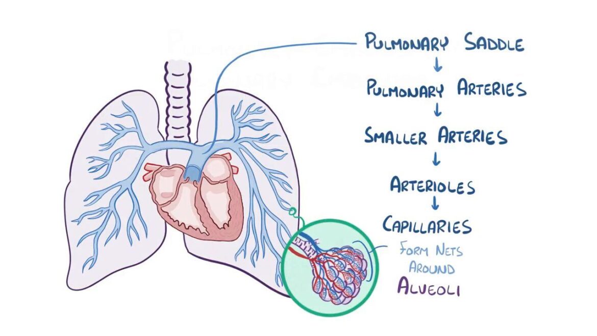 Pulmonary Embolism: Causes, Risks, and Treatments