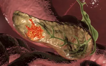 cancer patient — IN news